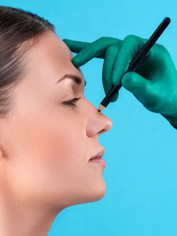 Rhinoplasty